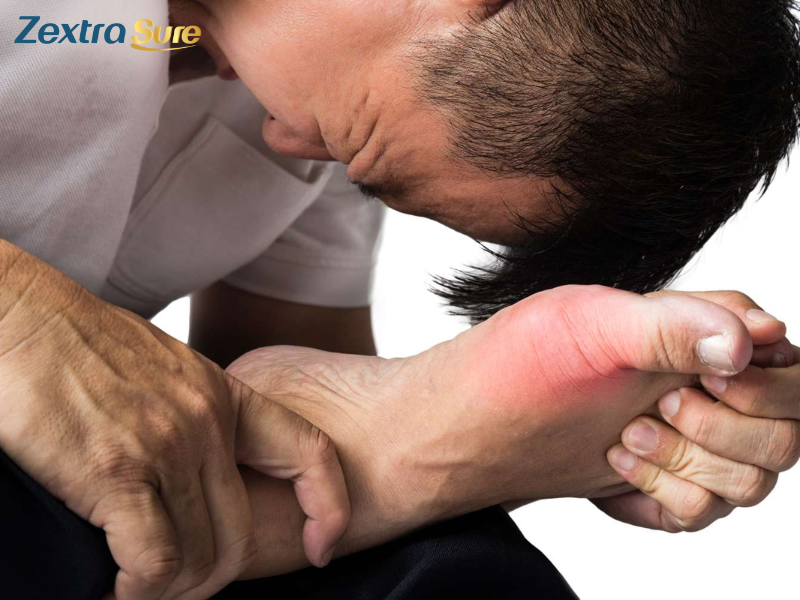 tophi gout removal (3)